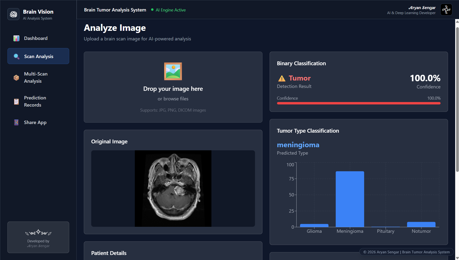 Brain Tumor Analysis System