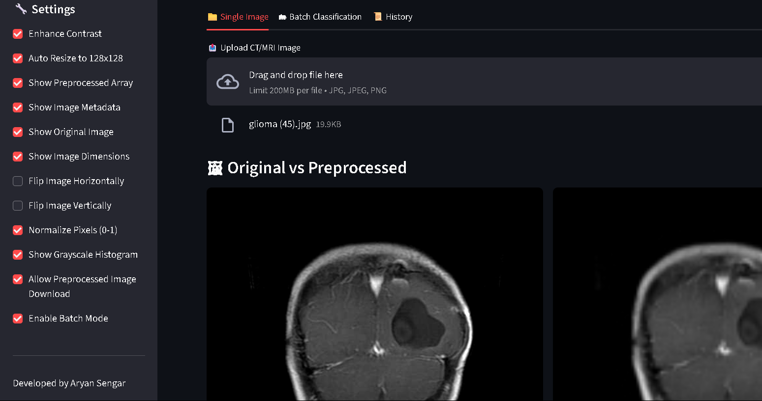 Brain Tumor Classification Project